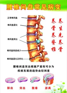 腰椎间盘常见病变图片