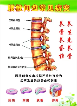 腰椎间盘常见病变图片