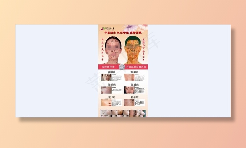 巨美人点痣图图片