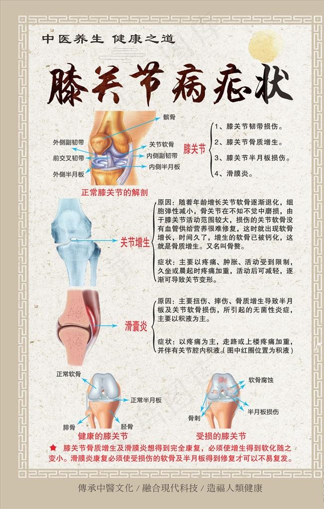 膝关节 骨科挂图图片cdr矢量模版下载