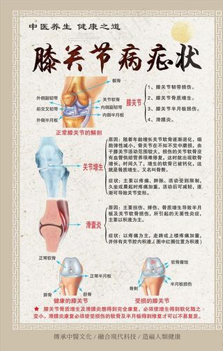 膝关节 骨科挂图图片