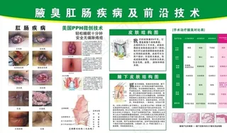 腋臭肛肠挂图图片