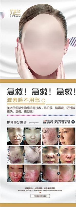 激素脸展架图片