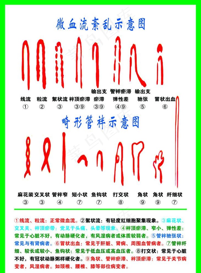 微血流紊乱示意图图片(2953x4134)psd模版下载