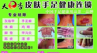 皮肤手足健康连锁图片