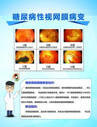 糖尿病性视网膜病变图片