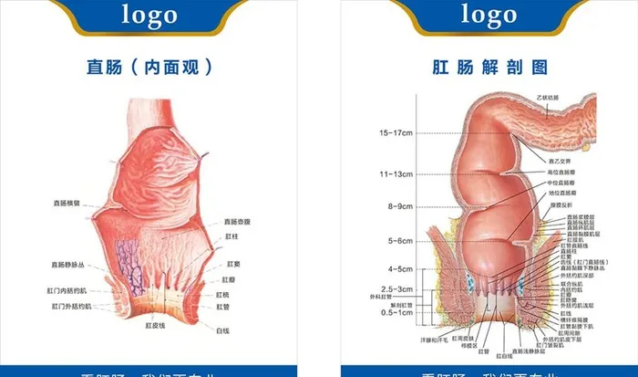 肛肠剖面图直肠内面图图片cdr矢量模版下载