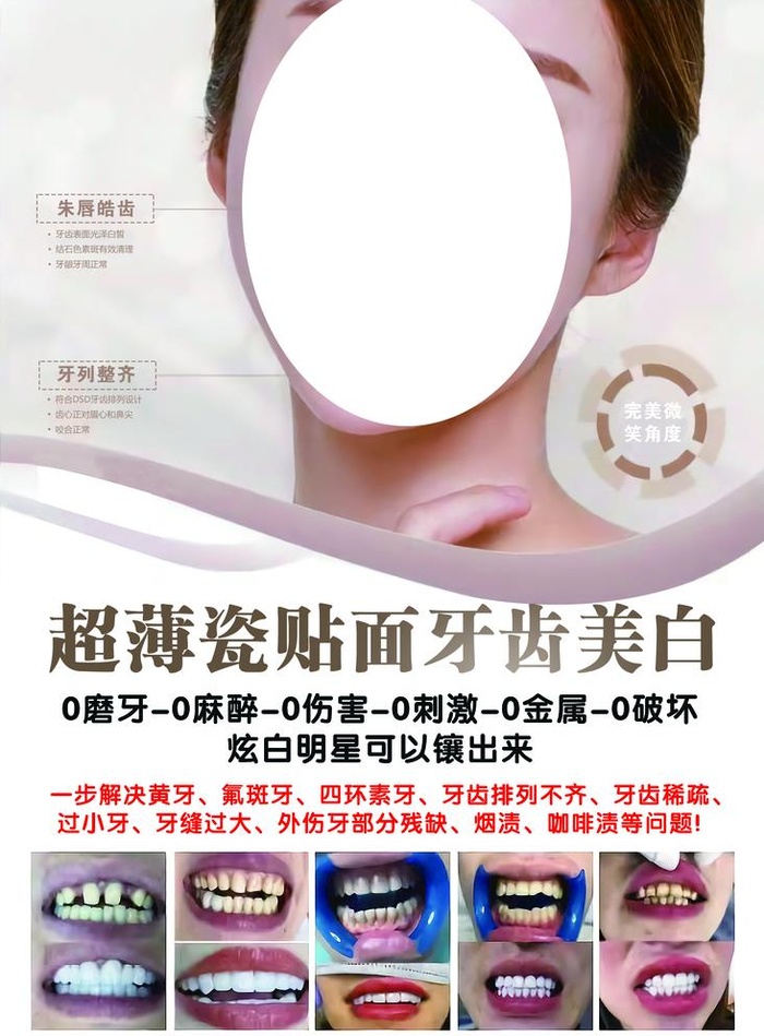 牙齿美白海报图片(1969x2756)psd模版下载