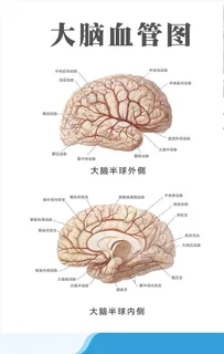 大脑血管图图片