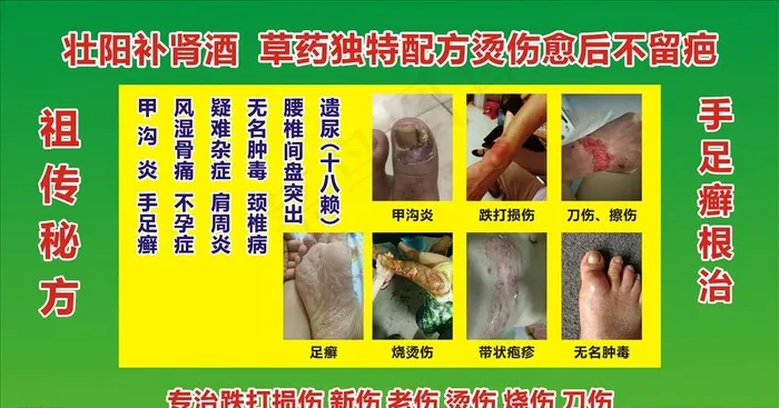 脚气 脚病 脚臭 脚痒 灰指甲图片cdr矢量模版下载