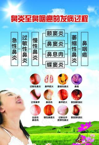 鼻炎发病过程图片