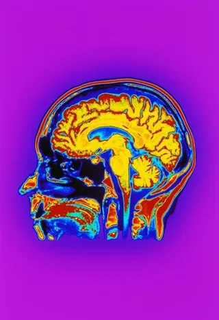 医学人体透视图片
