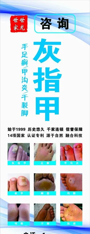 灰指甲展架图片cdr矢量模版下载