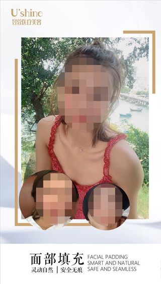 医美整形医院案例对比海报图片