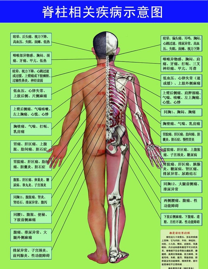 脊柱相关疾病示意图图片(2362x3150)psd模版下载