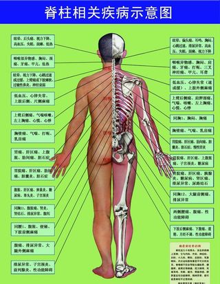 脊柱相关疾病示意图图片