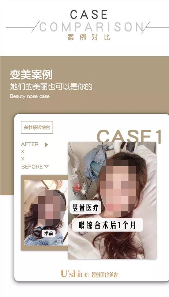 医美整形医院案例对比海报图片