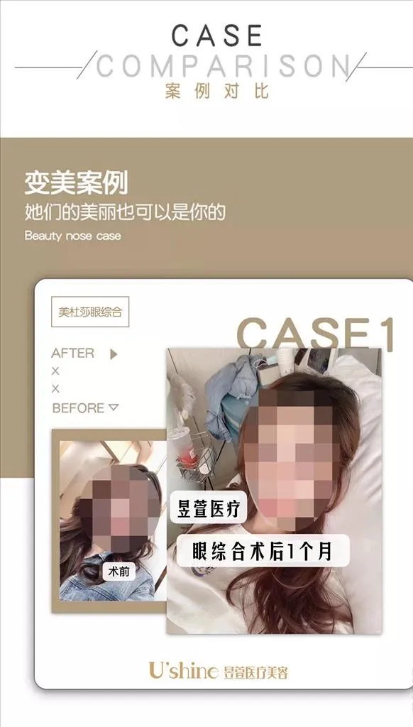 医美整形医院案例对比海报图片(2362x3937)psd模版下载