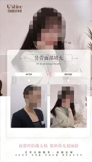 医美整形医院案例对比海报图片