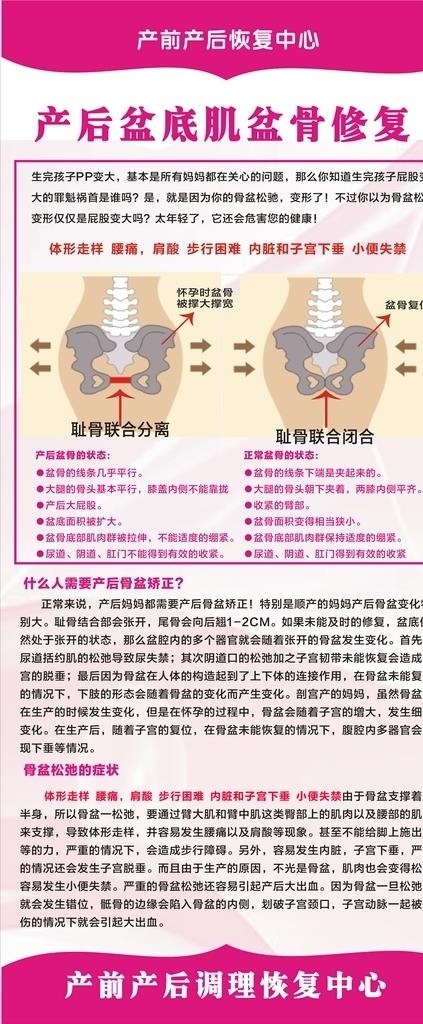 产后盆底股盆骨修复展架图片