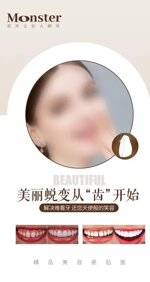 医美口腔贴面图片