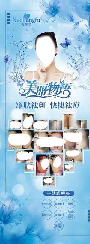 祛斑祛痘展架图片