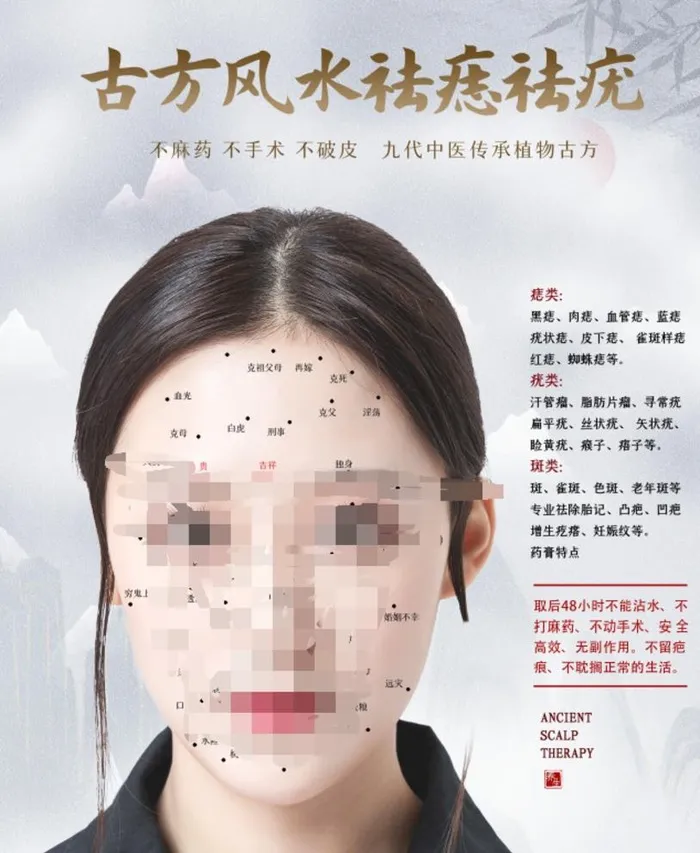 古风祛痣去疣图片(44x65)psd模版下载