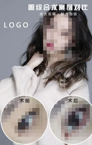 医美对比图图片