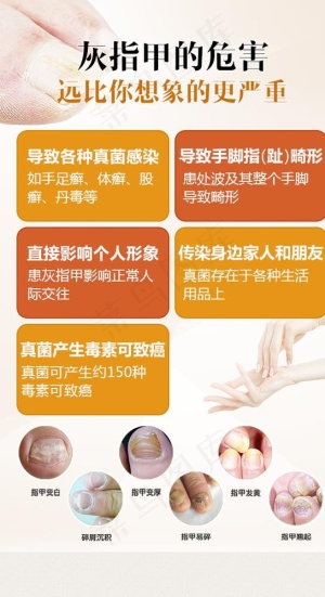 灰指甲危害图片