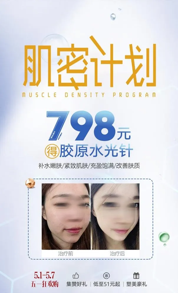 整形医美水光针创意活动海报图片(1080x1080)psd模版下载