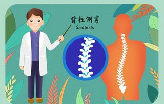 预防脊柱侧弯讲座图片