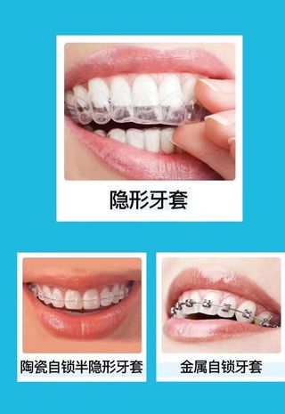 口腔海报图片
