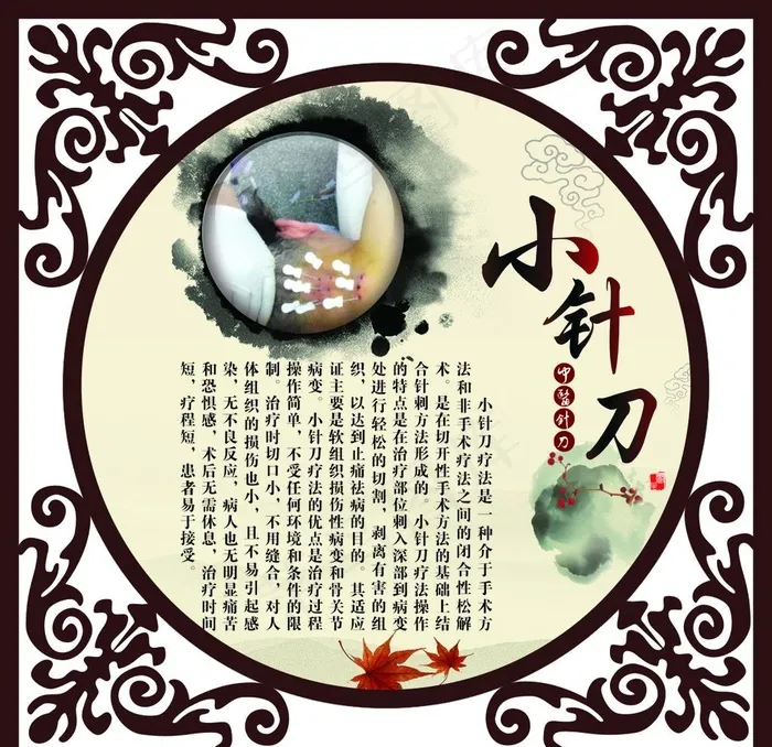 小针刀图片cdr矢量模版下载