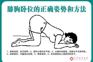 膝胸卧位的正确姿势和方法图片