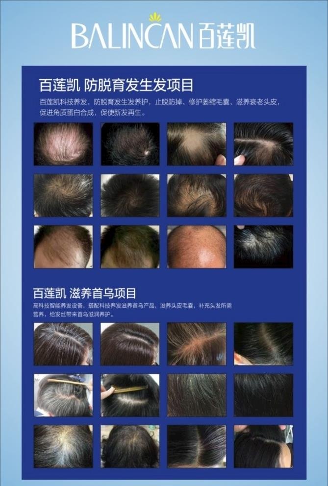 百莲凯防脱发图片cdr矢量模版下载