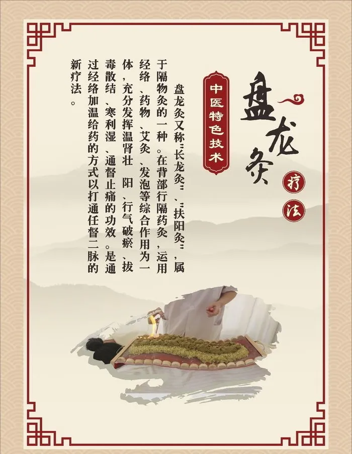 盘龙灸图片cdr矢量模版下载