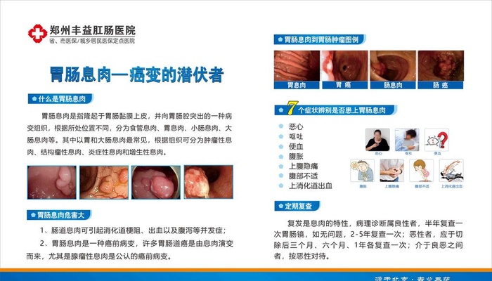 胃肠息肉展板图片cdr矢量模版下载