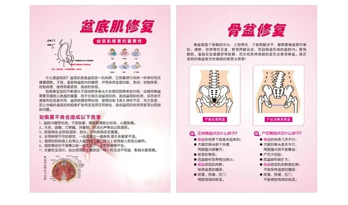 盆底肌修复骨盆修复图片
