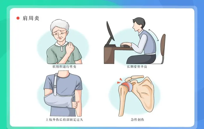 肩周炎疼痛保健背景海报素材图片(3000x2000)psd模版下载