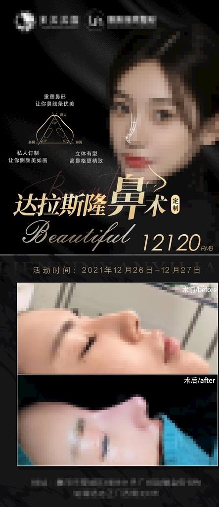 医美整形鼻子活动案例对比隆鼻图片(1080x2330)psd模版下载