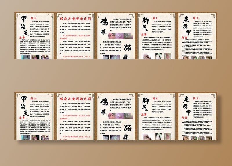 甲沟炎简介 危害  鸡眼图片(60x80)psd模版下载
