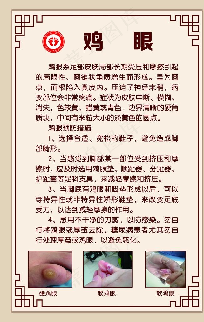 鸡眼图片(4724x7087)psd模版下载