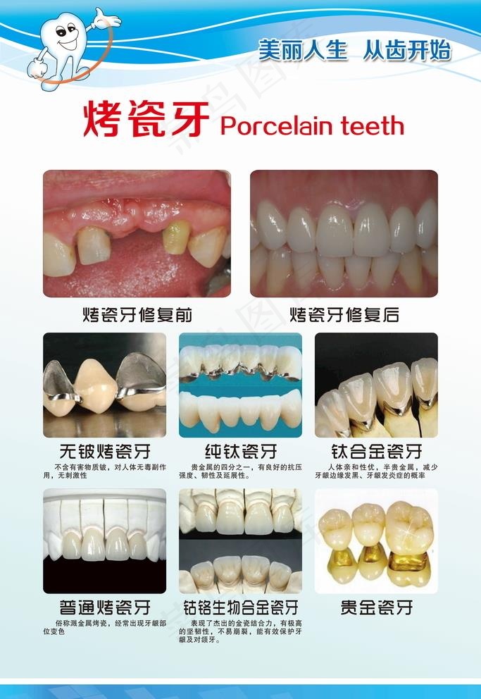 烤瓷牙图片(4724x7086)psd模版下载