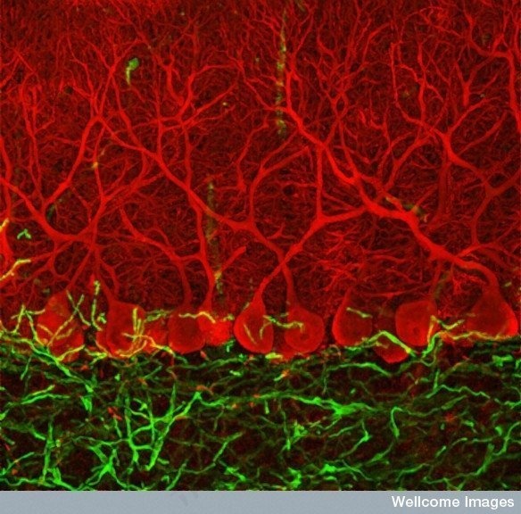 花卉,细胞图,绘画,背景素材,B0006224小脑中的浦肯野细胞
