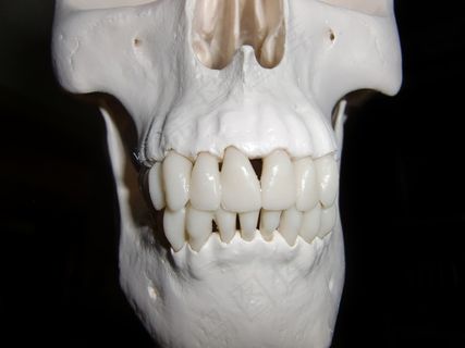 头骨，骨架，骷髅和交叉骨，骷髅骨