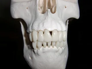 头骨，骨架，骷髅和交叉骨，骷髅骨