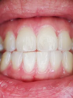 人类牙齿的特写 人类牙齿的特写