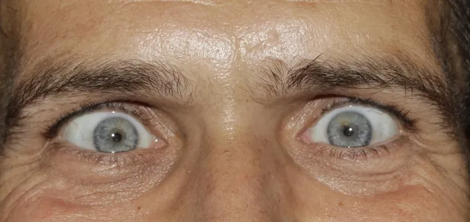 眼睛，见，斜纹，虹膜，学生，睫毛，眉毛