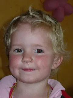 儿童，女孩，脸，微笑，厚脸皮，金发，鼻子，Rotznase