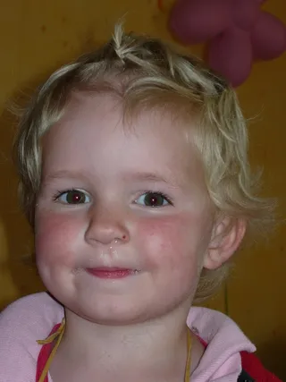 儿童，女孩，脸，微笑，厚脸皮，金发，鼻子，Rotznase